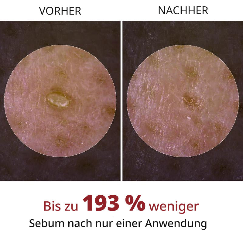 Rollerkking Reis-Ampullen Set für strahlende Haut