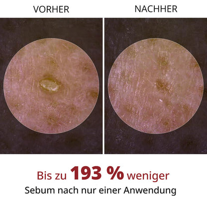 Rollerkking Reis-Ampullen Set für strahlende Haut