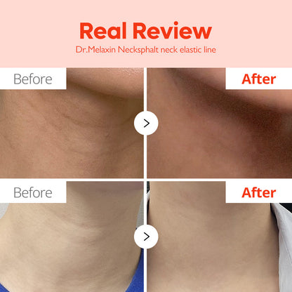 Neck Barrier Repair Cream